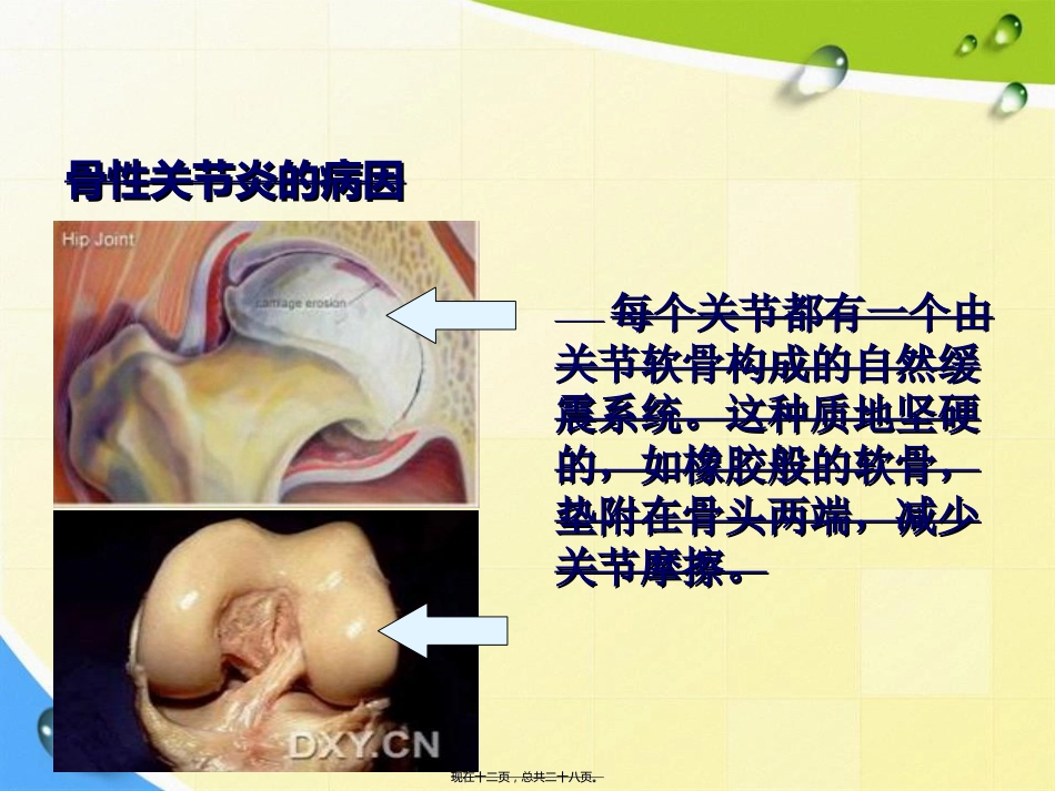 老人骨性关节炎诊疗患教讲课文档_第12页