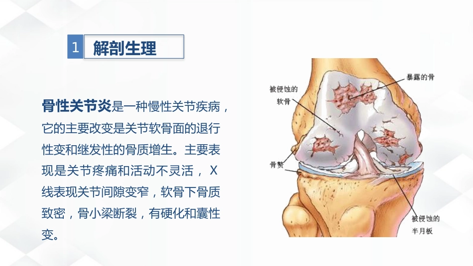 骨科-双膝骨性关节炎护理查房_第4页