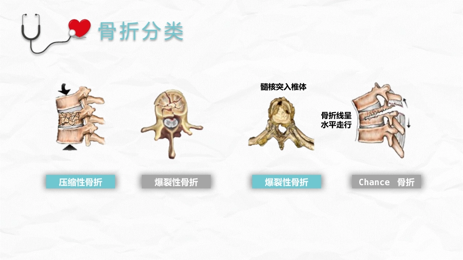腰椎压缩性骨折护理业务_第7页