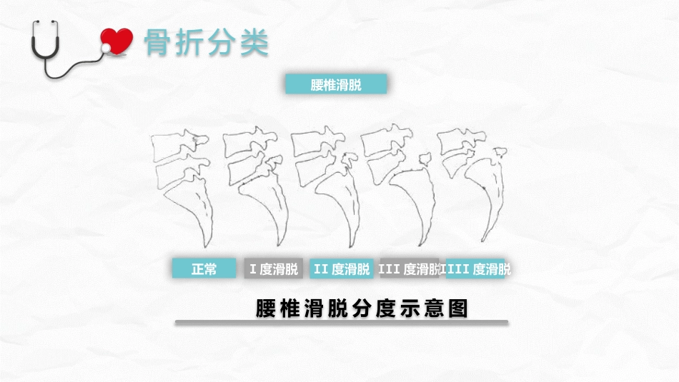 腰椎压缩性骨折护理业务_第8页