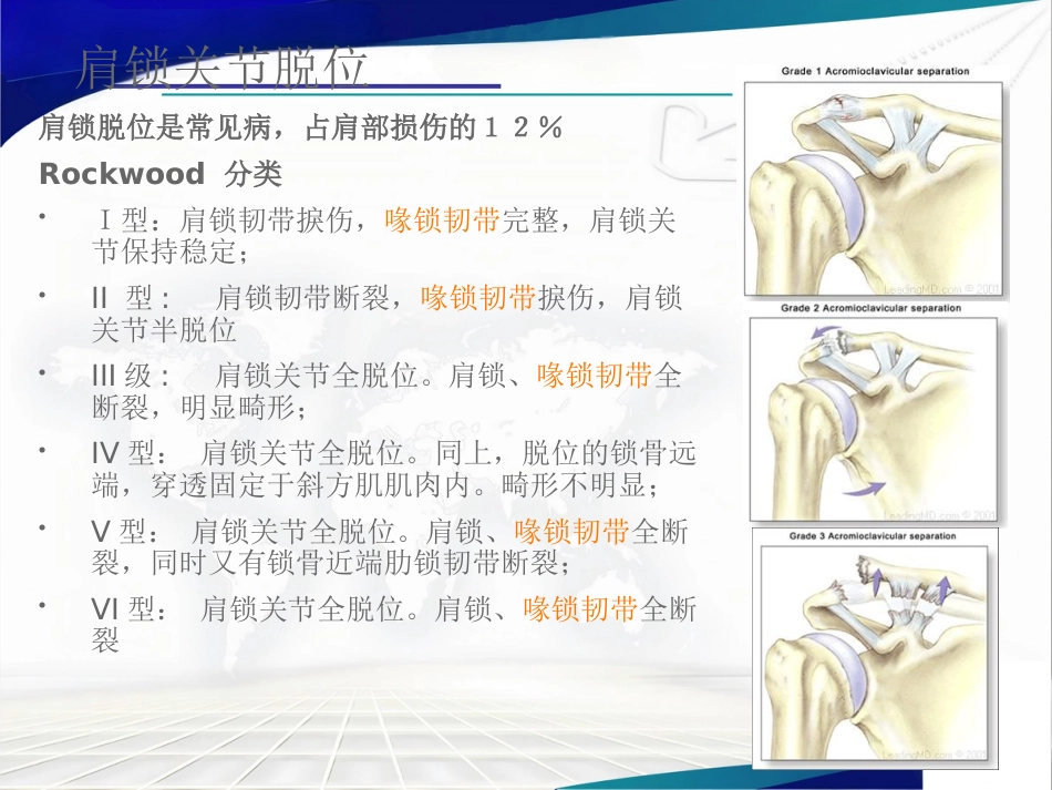 双ENDOBUTTON技术重建肩锁关节_第4页