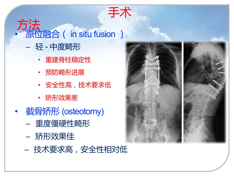 陈旧性结核后凸的手术治疗_第11页