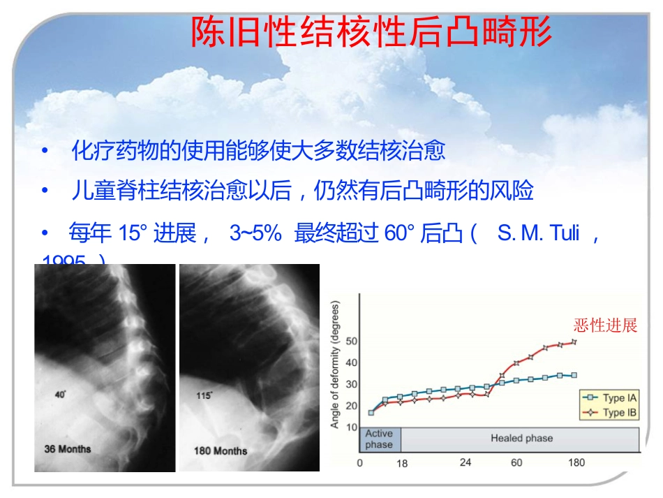 陈旧性结核后凸的手术治疗_第2页