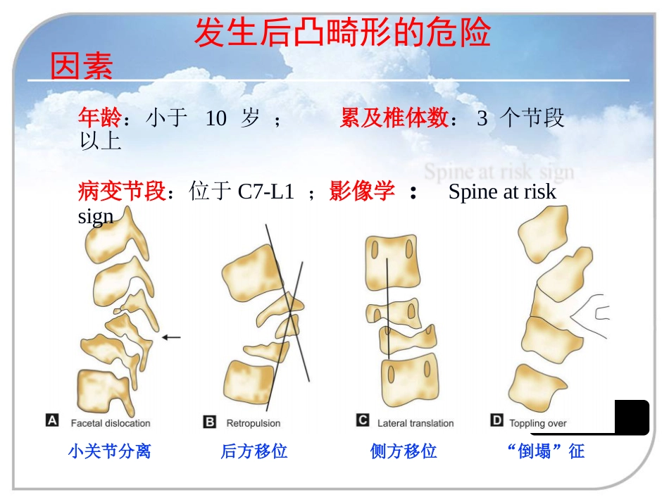陈旧性结核后凸的手术治疗_第3页