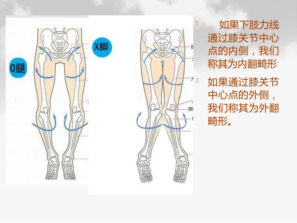全膝膝关节置换基本理论_第10页