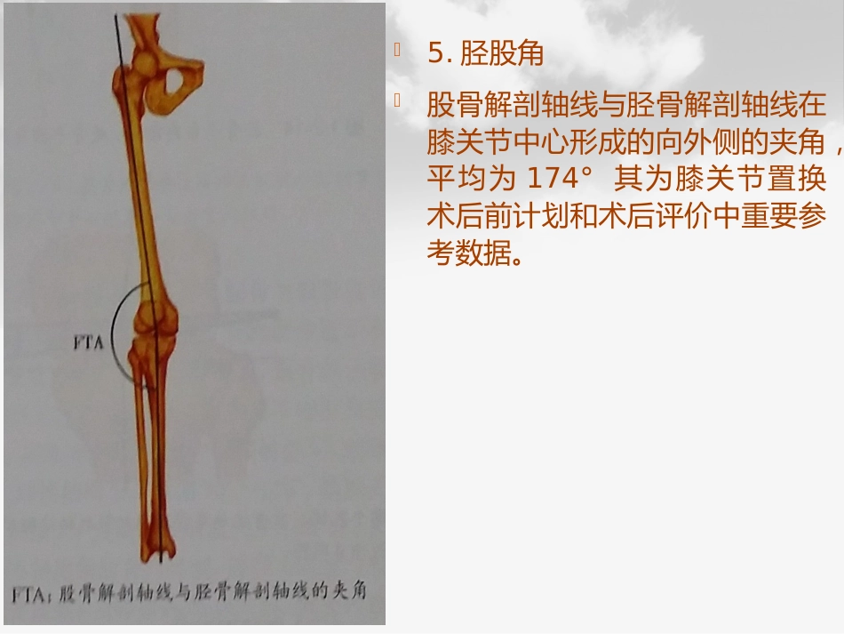 全膝膝关节置换基本理论_第15页