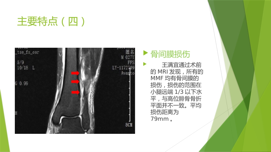 特殊类型的踝关节骨折_第10页