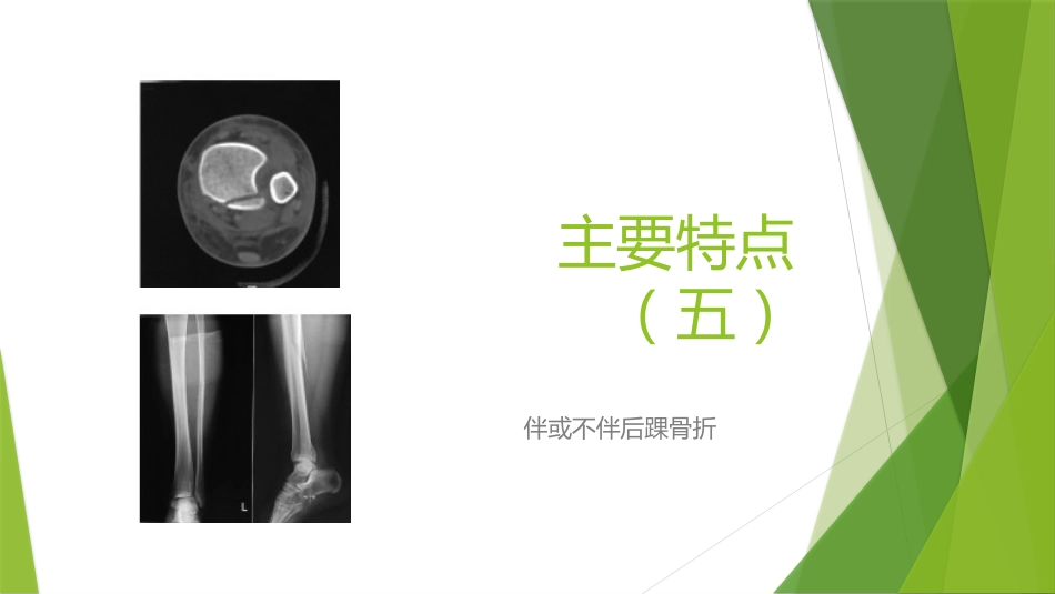 特殊类型的踝关节骨折_第11页