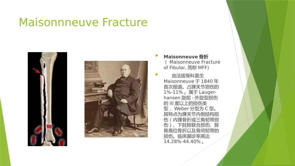 特殊类型的踝关节骨折_第4页