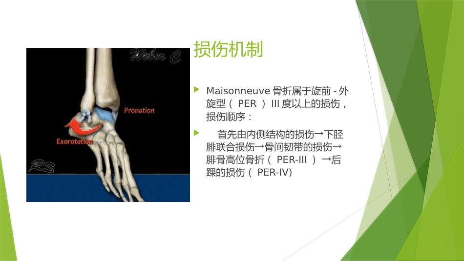 特殊类型的踝关节骨折_第5页