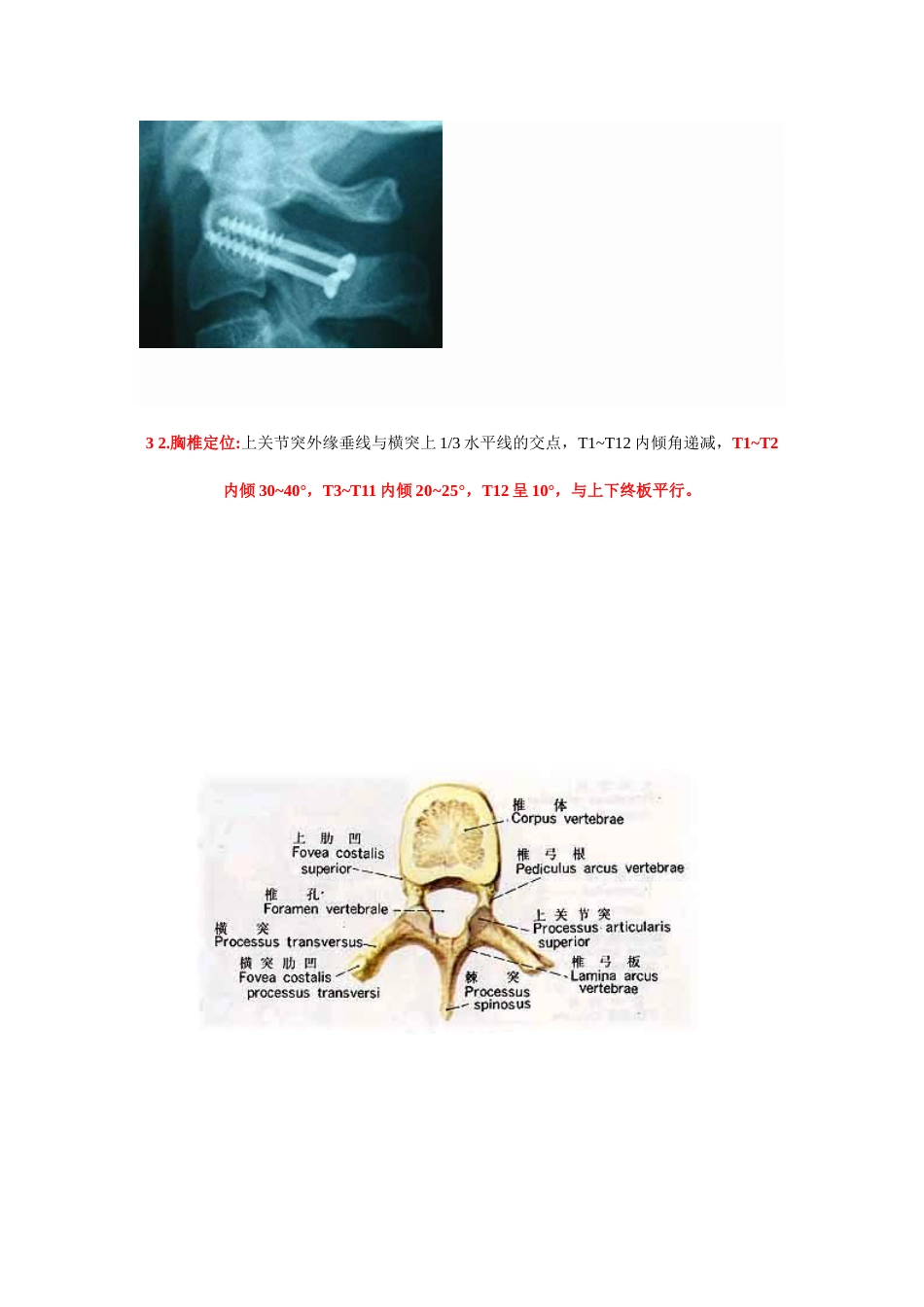 脊椎椎弓根钉进钉点的确定及手术技巧_第5页