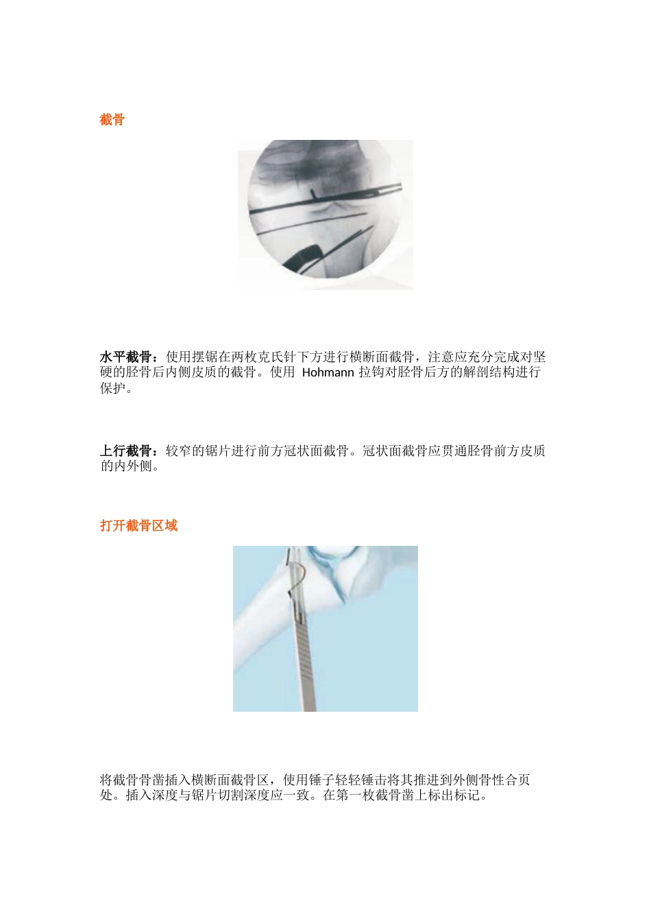 胫骨高位截骨术的手术步骤及技巧_第11页