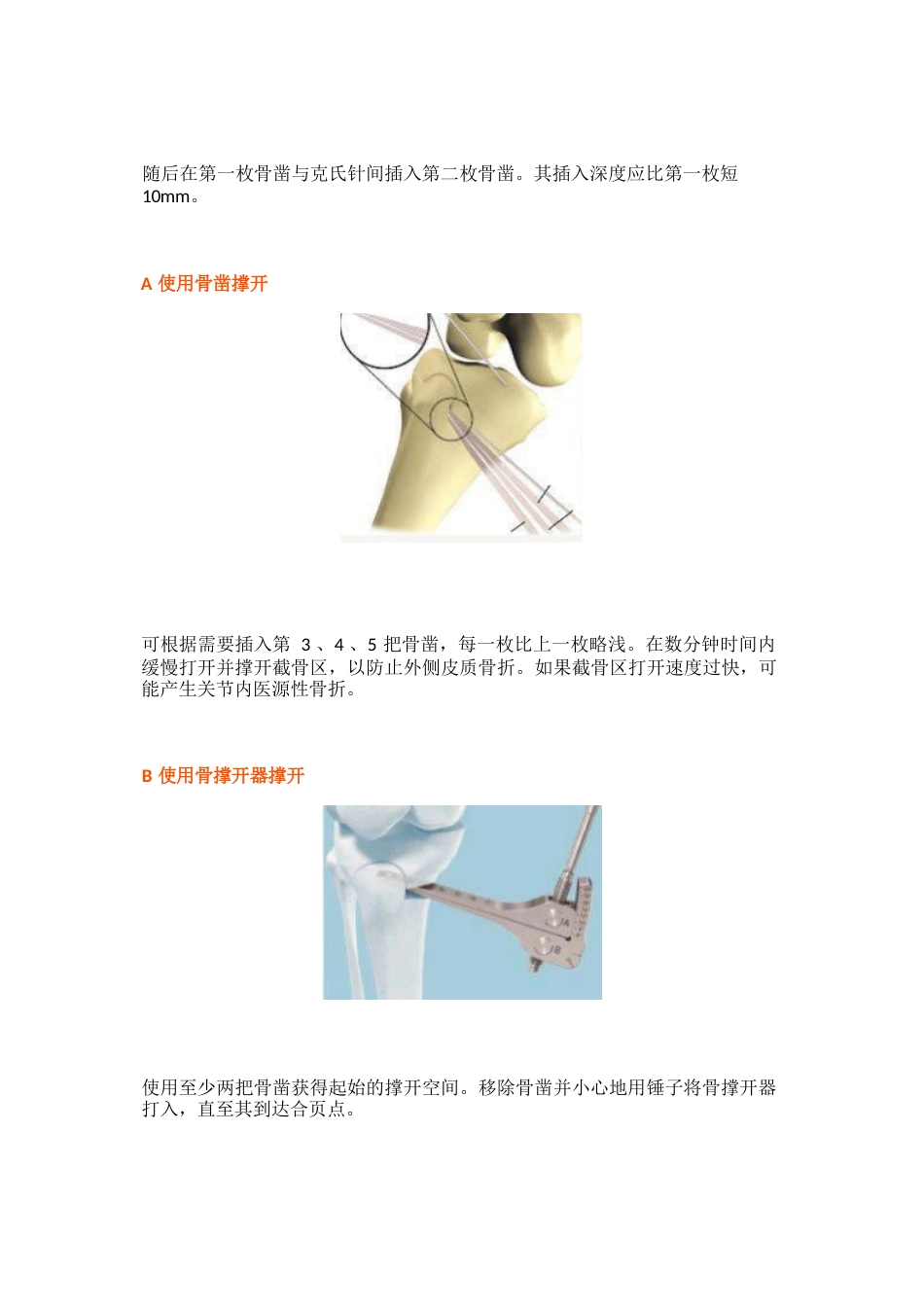 胫骨高位截骨术的手术步骤及技巧_第12页