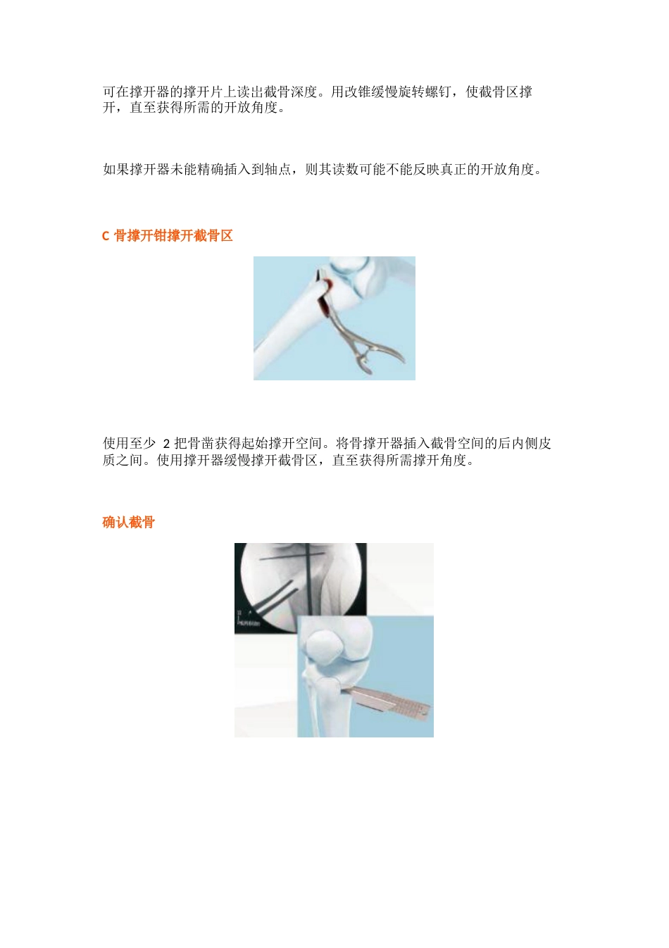 胫骨高位截骨术的手术步骤及技巧_第13页