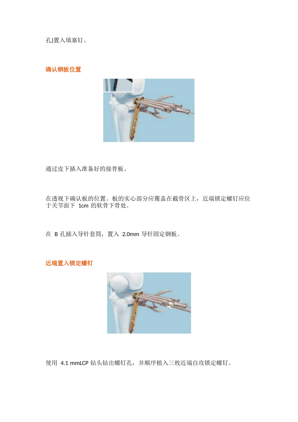 胫骨高位截骨术的手术步骤及技巧_第15页