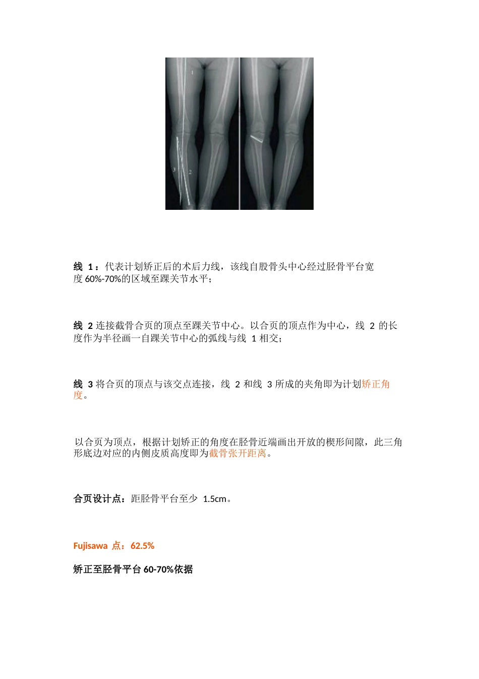 胫骨高位截骨术的手术步骤及技巧_第6页