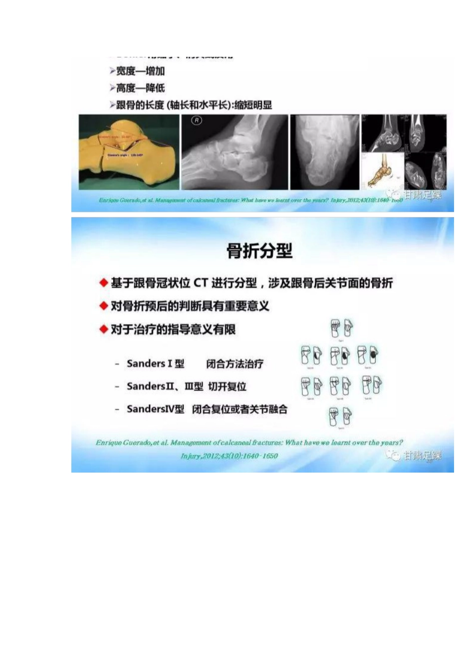 经跗骨窦切口治疗跟骨骨折_第5页