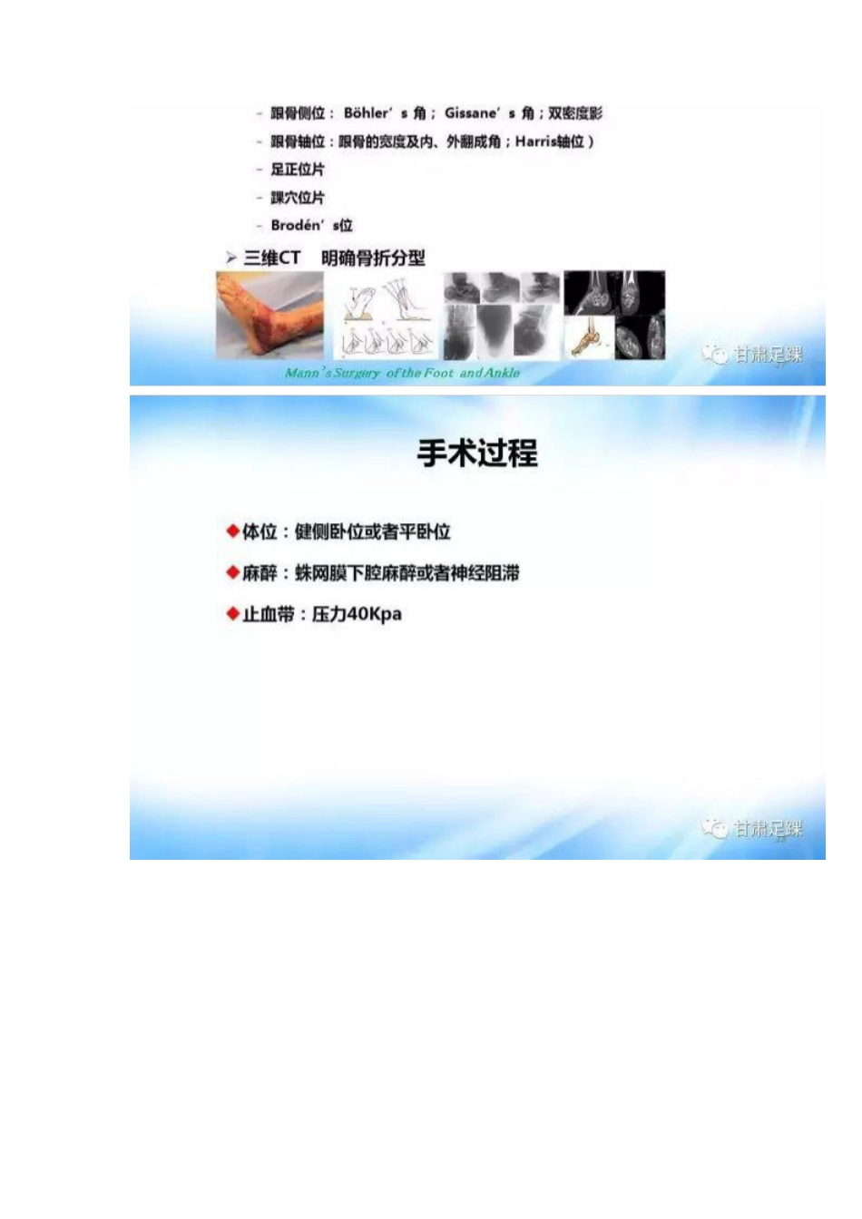 经跗骨窦切口治疗跟骨骨折_第9页