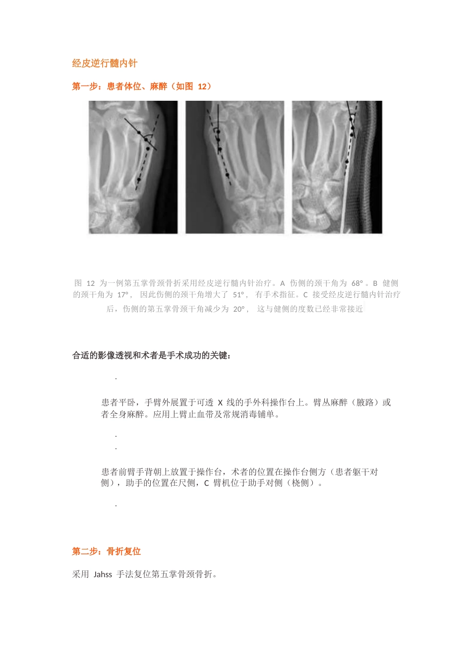 髓内针治疗移位性掌骨颈骨折技术_第12页