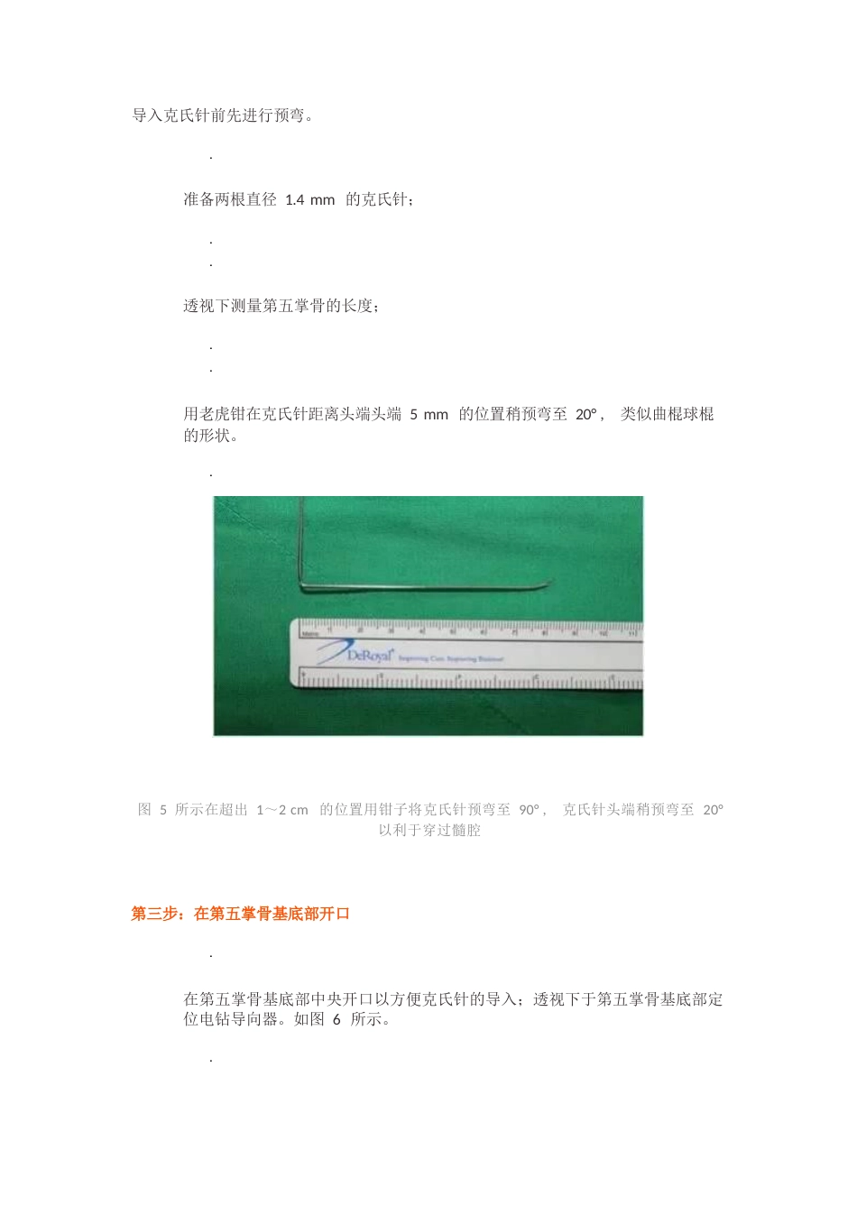 髓内针治疗移位性掌骨颈骨折技术_第6页