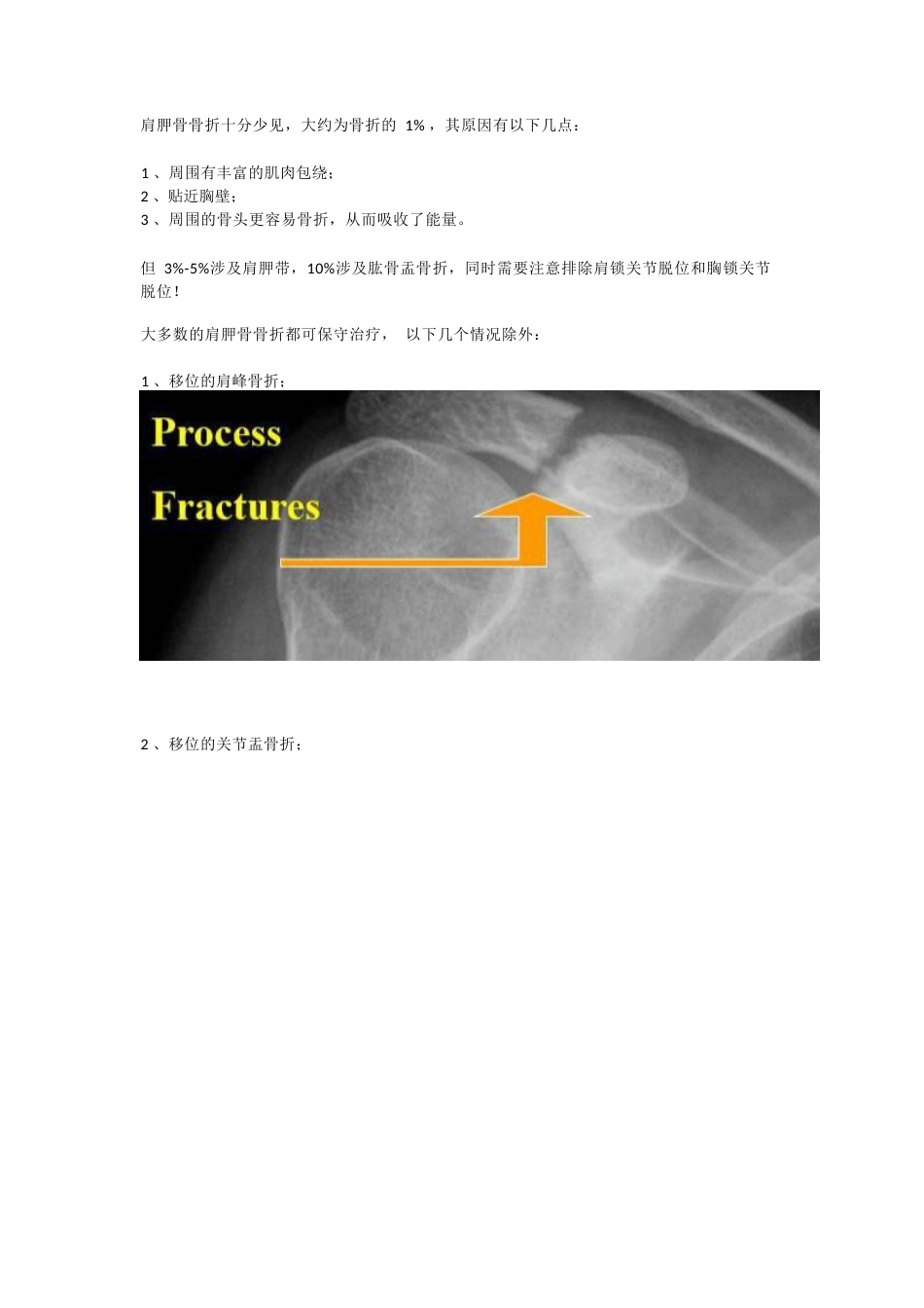 肩胛骨骨折的内固定手术技巧_第1页