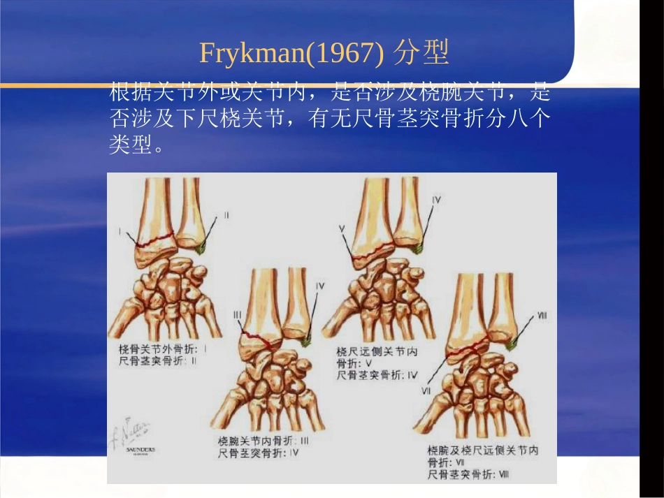 桡骨远端骨折治疗_第14页