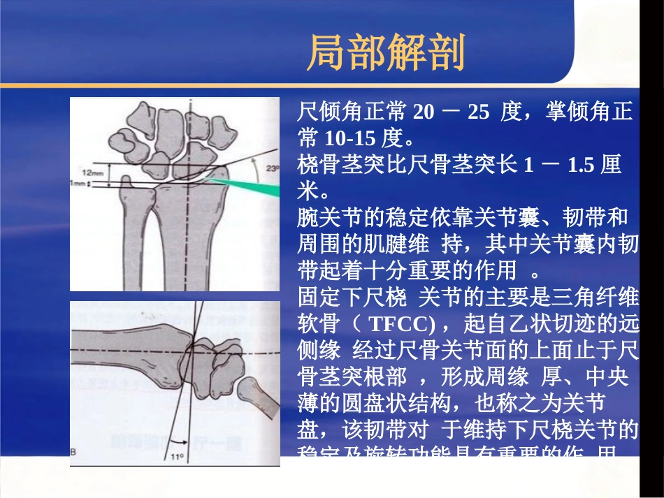 桡骨远端骨折治疗_第3页