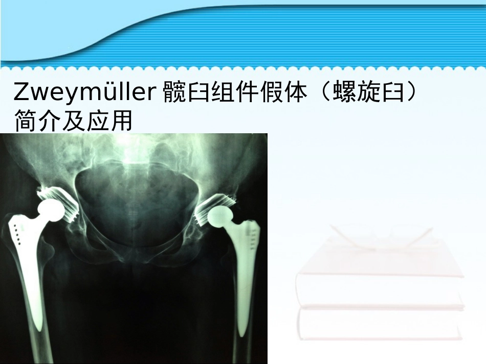 螺旋臼要点_第1页