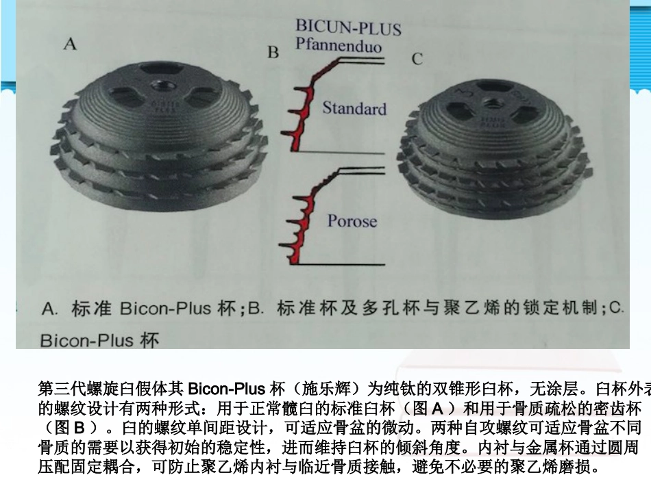 螺旋臼要点_第8页