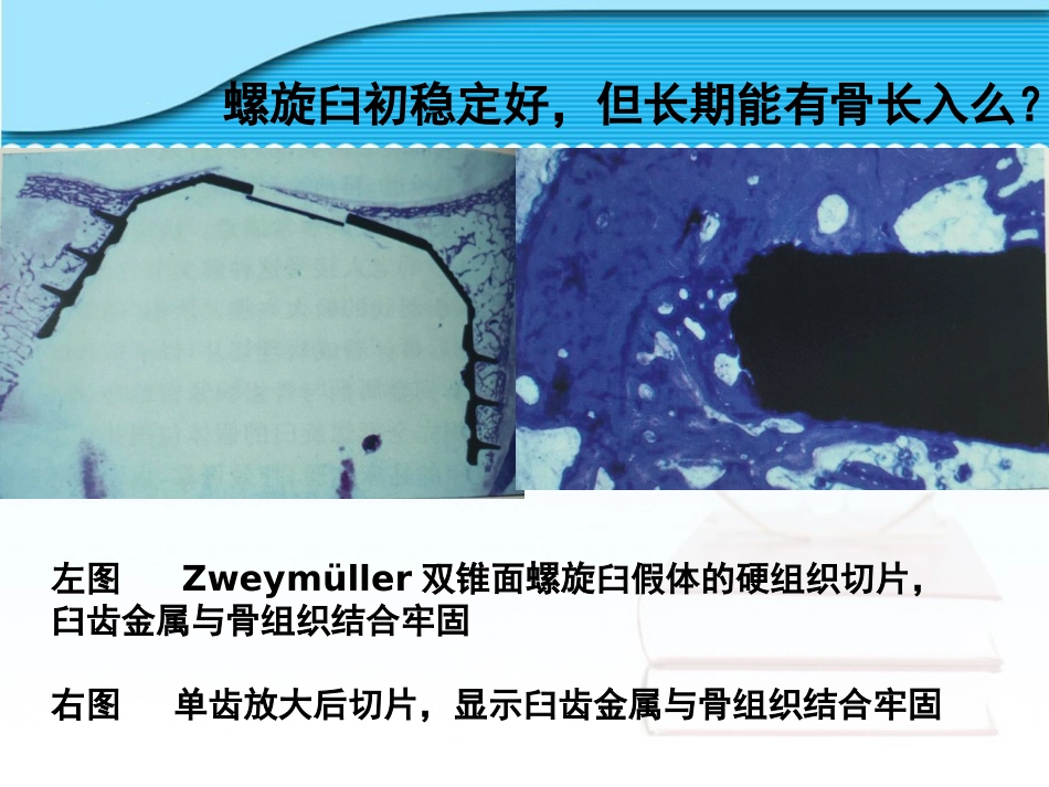 螺旋臼要点_第9页