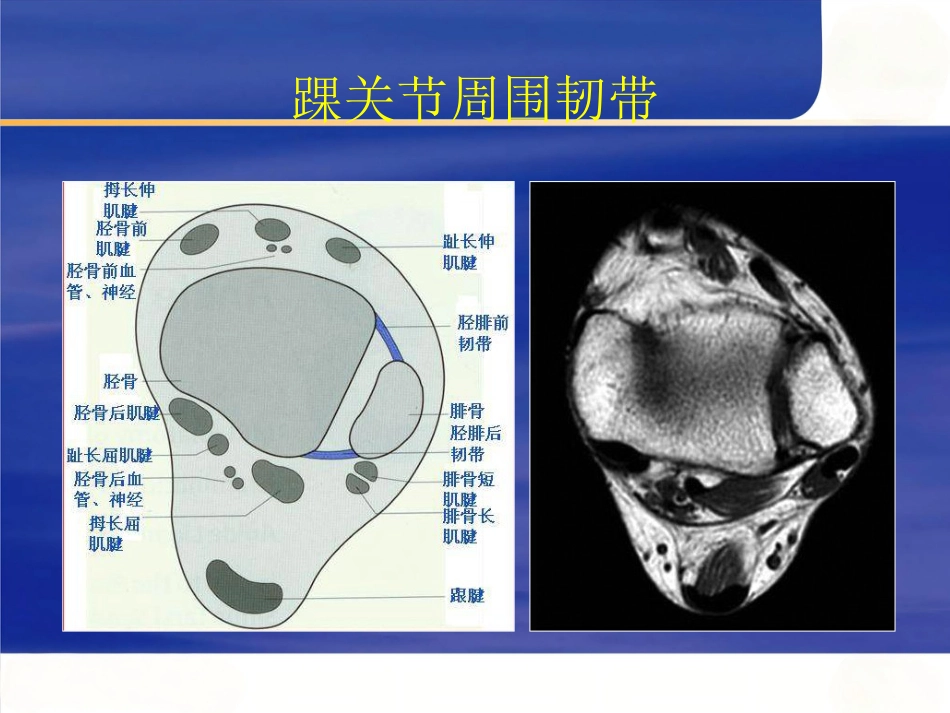 踝关节撞击综合征影像学_第6页