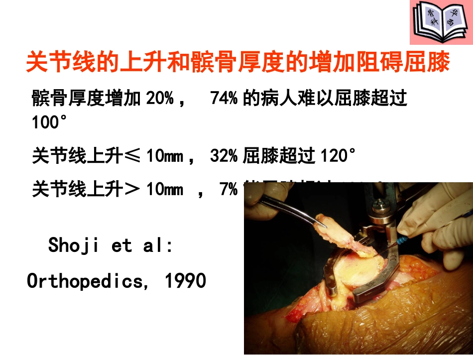 全膝关节置换的手术原则PPT_第10页