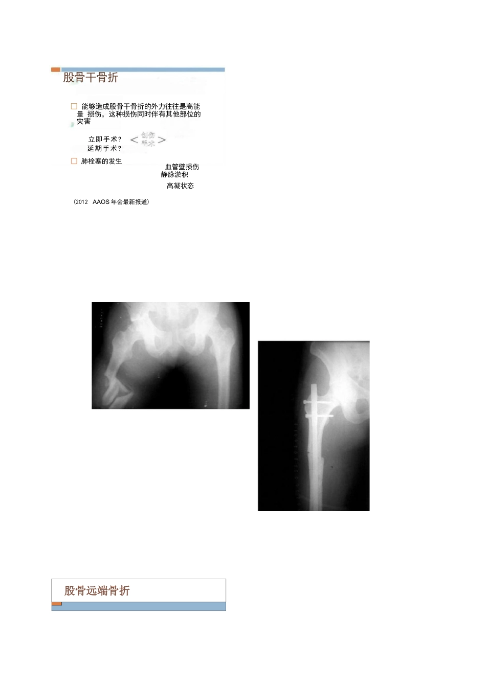 各部位骨折的手术时机选择_第10页