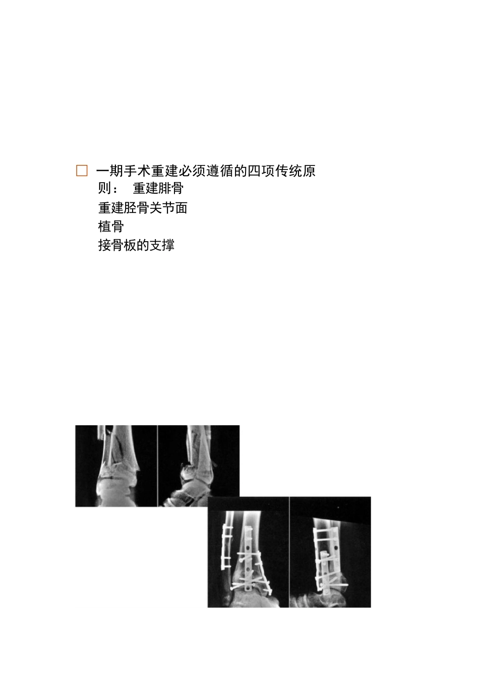 各部位骨折的手术时机选择_第14页