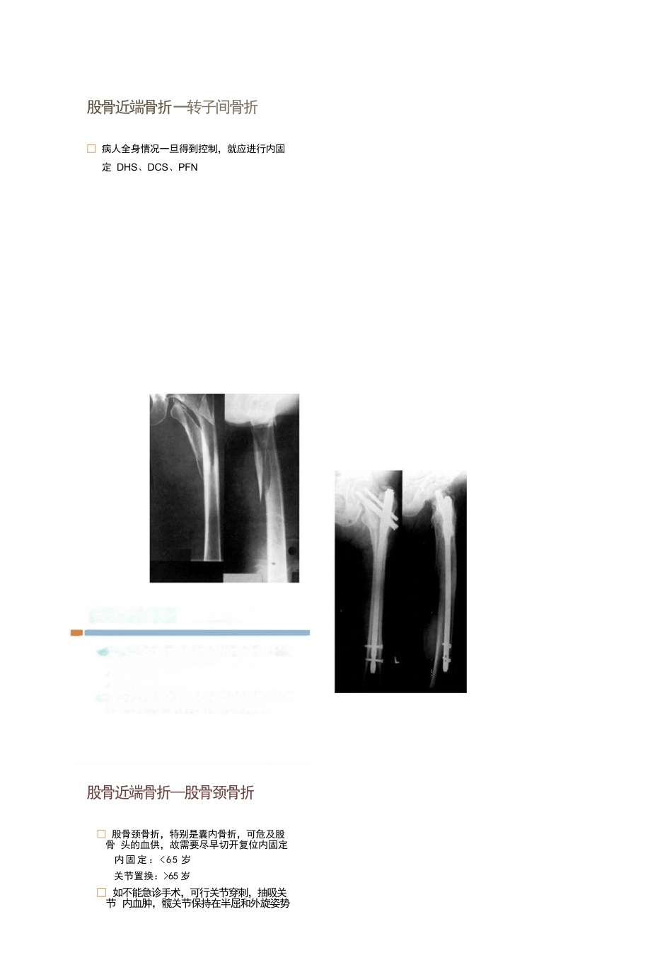 各部位骨折的手术时机选择_第9页