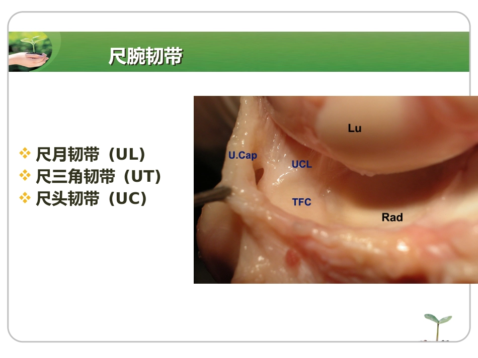 腕关节镜_第14页