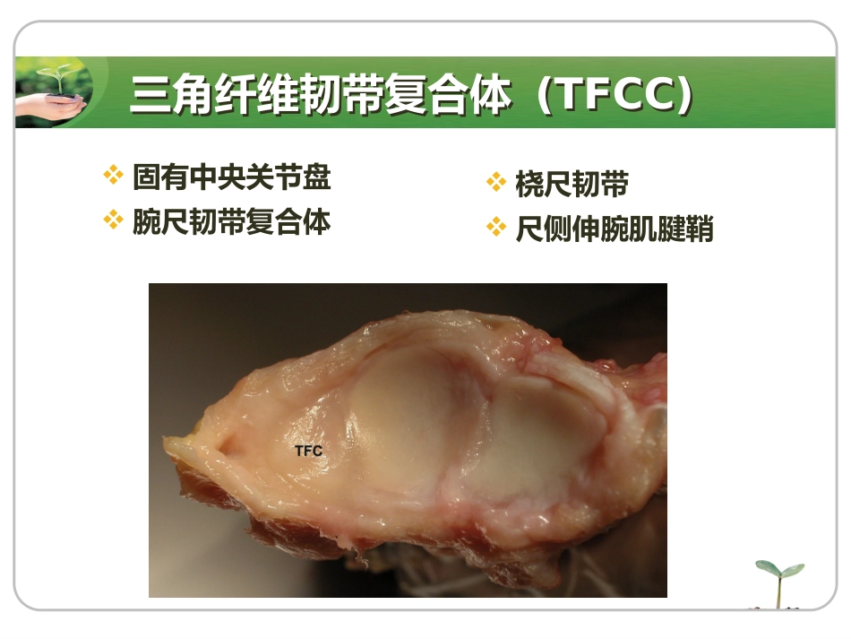 腕关节镜_第15页