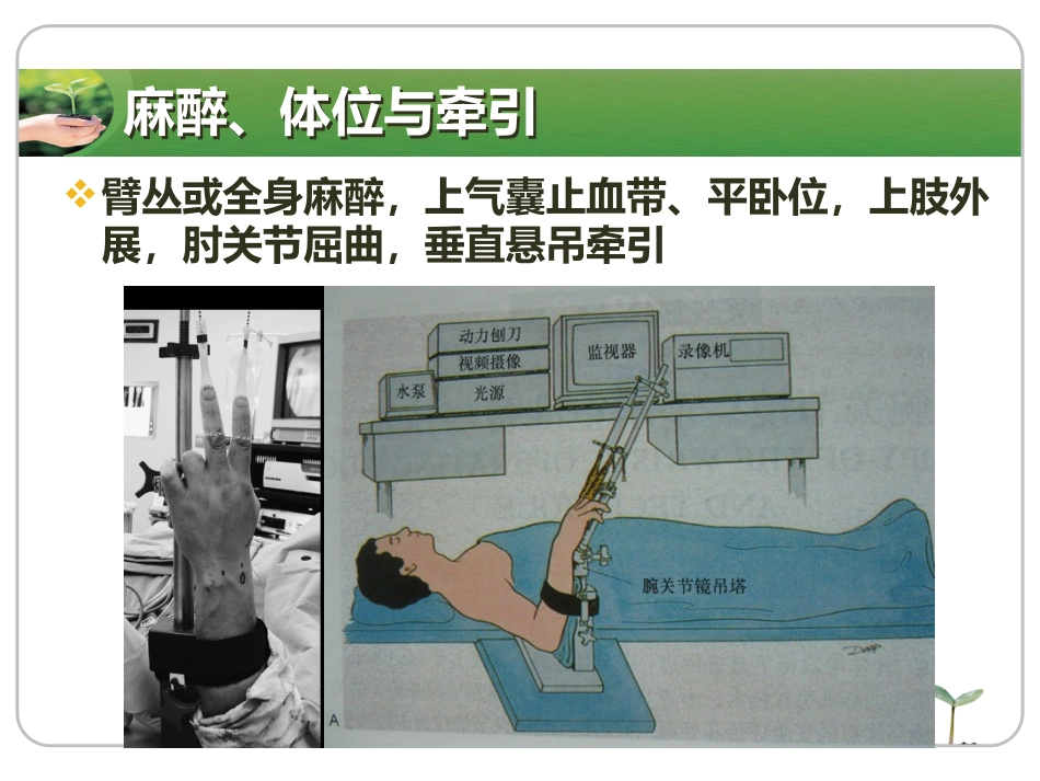 腕关节镜_第7页