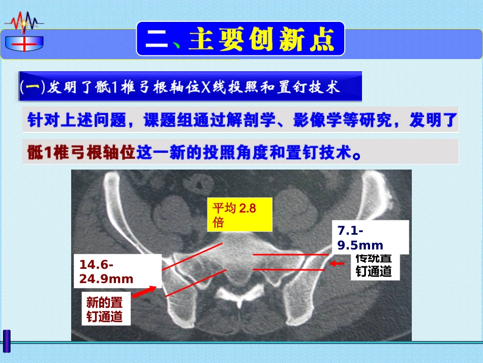 微创治疗骨盆髋臼 ZH骨折 弹性固定 锁骨复位器_第14页