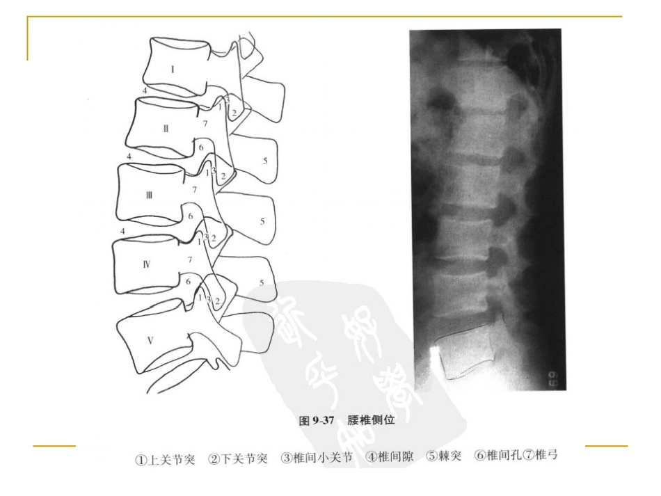 脊柱x片诊断_第12页