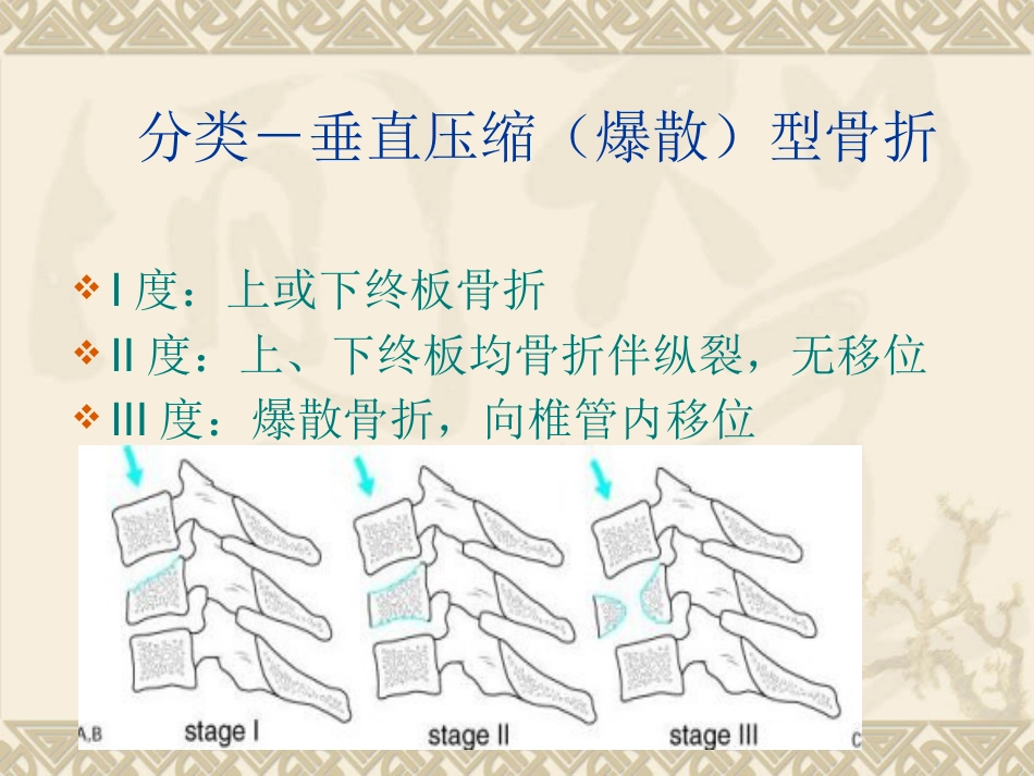 颈椎骨折脱位诊断与治疗_第7页