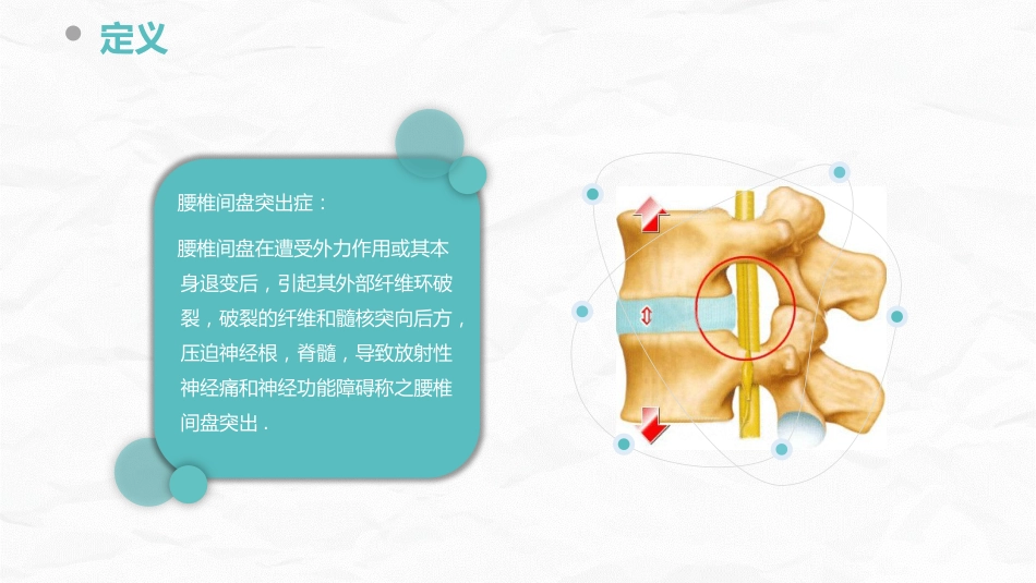 腰椎间盘突出症的康复护理_第5页