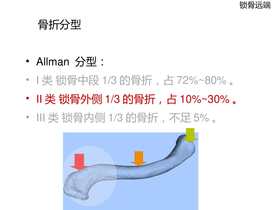 锁骨远端骨折_第2页