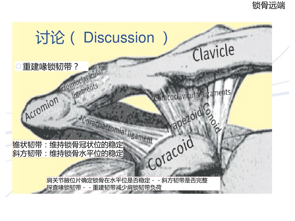 锁骨远端骨折_第5页