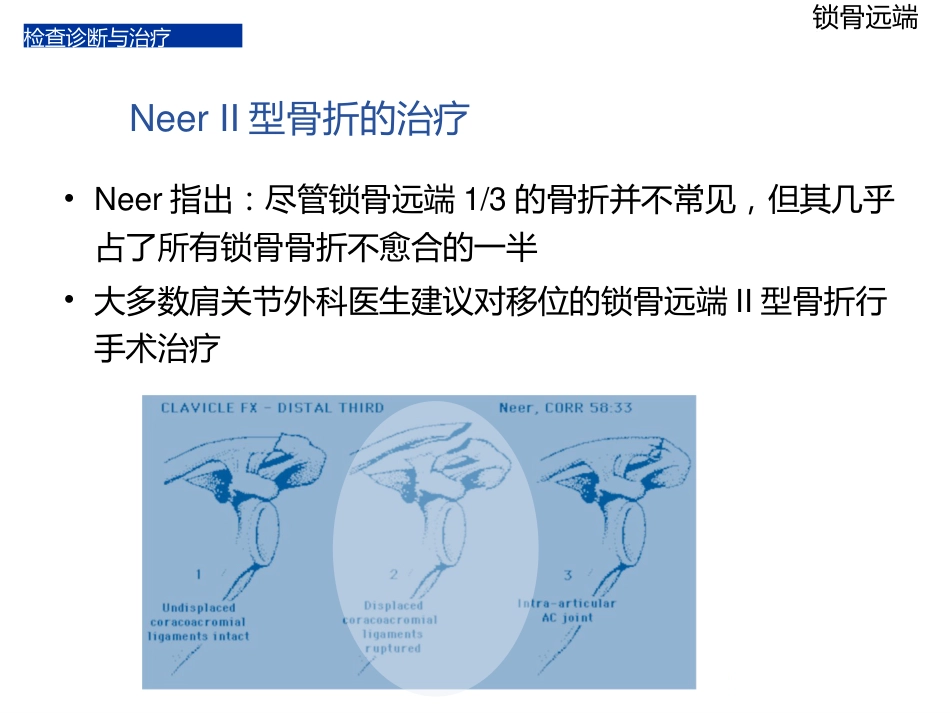 锁骨远端骨折_第8页