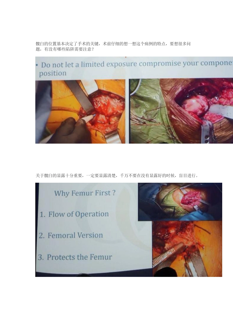髋关节置换手术中如何做一个好的髋臼_第2页