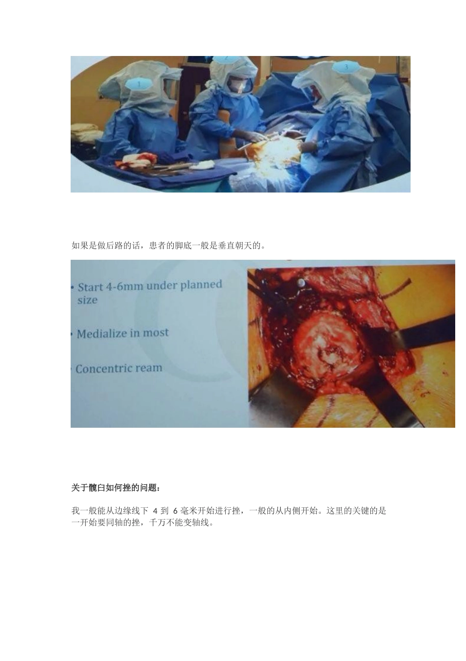 髋关节置换手术中如何做一个好的髋臼_第4页