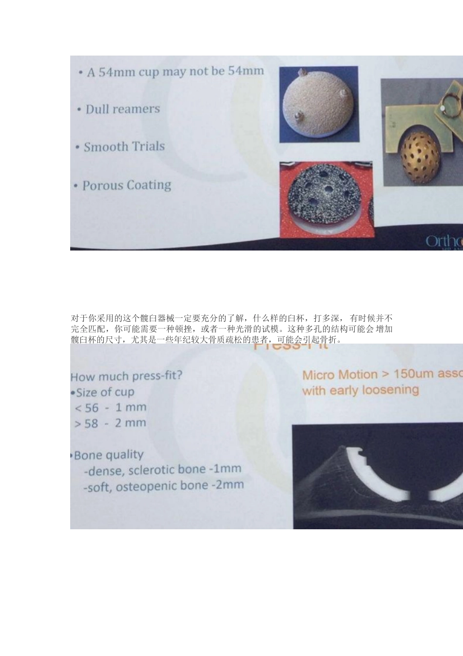 髋关节置换手术中如何做一个好的髋臼_第7页