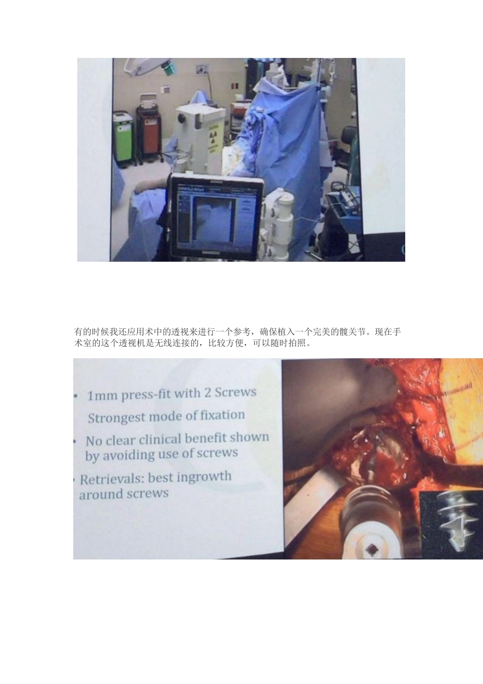 髋关节置换手术中如何做一个好的髋臼_第9页