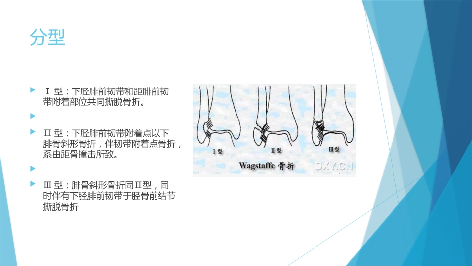 特殊类型的踝关节骨折（下）_第15页